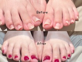 ペディバランスフットケア