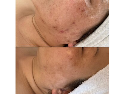 リュミエール(Lumie're)の写真