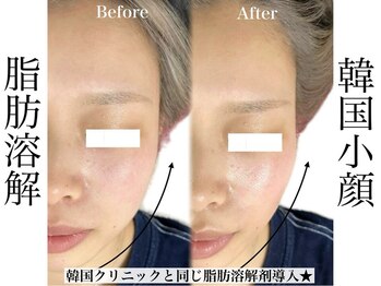 リベルキョウト 京都駅前店(Liber Kyoto)/レモンボトル超え!二重顎撃退