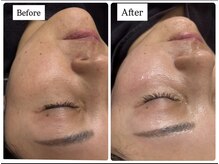 アオレニア(ao.lenia)の雰囲気（最新美容液導入でキュッと引き締まった小顔印象へ♪肌質改善も◎）