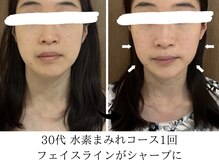 ヨサパーク タキ 上野毛(YOSA PARK TAKI)/30代・水素まみれコース1回