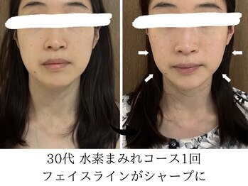 ヨサパーク タキ 上野毛(YOSA PARK TAKI)/30代・水素まみれコース1回