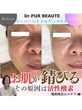 エステティックサロン ラ アクア(ra aqua)/お肌が錆びる？！活性酸素除去