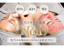 ルイス(LOUIS)の雰囲気(20代・30代~のあらゆる毛穴のお悩みお任せ下さい☆)