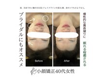 ルーツ(Roots)の雰囲気（頭痛に悩むあなたに。疲れ顔・体がその日に整う。）
