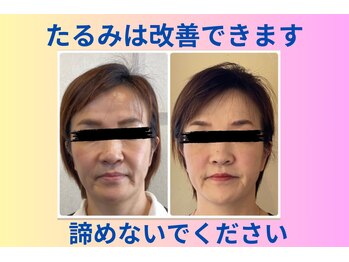 ねこのひげ/お客様の顔の変化