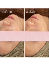 アイリーン(IRENE)/お肌の定期的なメンテナンスに☆