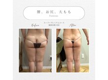 メゾンドフォレスト(Maison de Forest)の雰囲気（小顔・Vライン・美白・脂肪・シミケア・ブライダル・痩身）