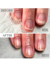 ビエル(BIeL)/魅せられる手元に♪縦長美爪