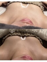 ルノン(Lunon)/離れ乳/谷間づくり