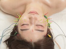 もり鍼灸整骨院 今出川マッサージ治療院/美容鍼灸/鍼灸/指圧/自律神経