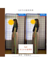 あらかき接骨院/【姿勢の変化】