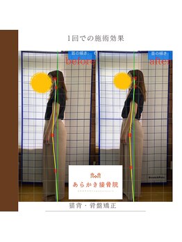あらかき接骨院/【姿勢の変化】