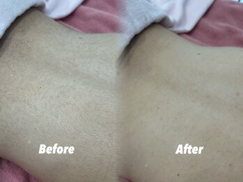 クイーン 渋谷店(QUEEN)/腰回りも油断大敵！