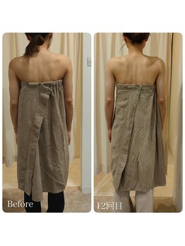 ルノン(Lunon)/《不調改善》歪み・辛い肩こり