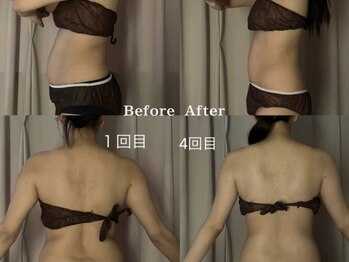 カオリ バイ レゴリス(馨 by REGOLITH)/《最新マシン》ウルトラ筋膜ケア