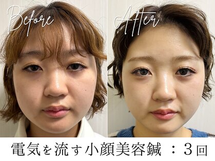 フラット(flat)の写真