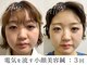 フラット(flat)の写真