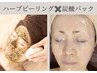 【肌悩み根本改善】ハーブピーリング【選べるop】×高濃度炭酸パック¥14300