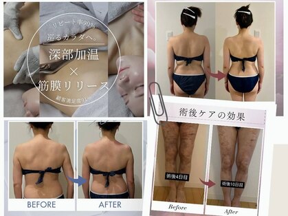 エンク(ENQU)の写真
