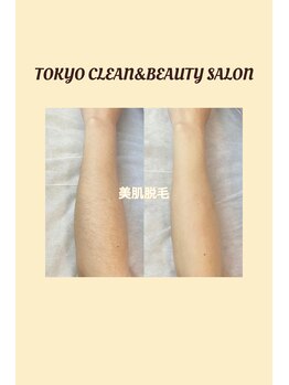 クリーン アンド ビューティー/★最新脱毛★産毛まで対応