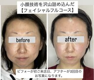 エミナル(EMINARU)
