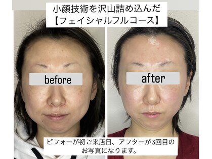 エミナル(EMINARU)の写真