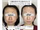 エミナル(EMINARU)の写真