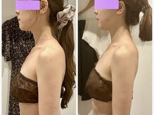 エステティックサロン アンジュ(Ange)/コルギで３６０度美人・姿勢改善