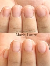 マリーロール 淀屋橋本店(Marie Laure)/自爪育成/深爪矯正/ネイルケア
