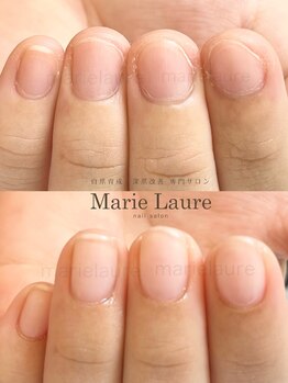 マリーロール 淀屋橋本店(Marie Laure)/自爪育成/深爪矯正/ネイルケア