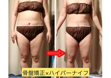 サクラス(SUQRAS)