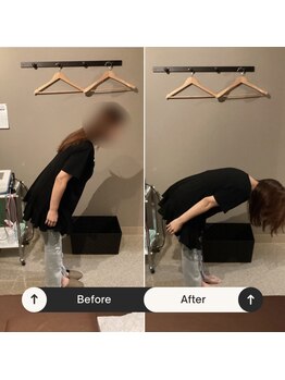 トータルボディケア整体 長居駅前店/腰痛ビフォーアフター！