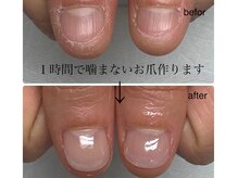 ココ ネイル サロン アンドスクール(COCO.NAIL SALON＆SCHOOL)の雰囲気（爪噛み卒業したい方、お任せください◎綺麗な指先になりましょう）