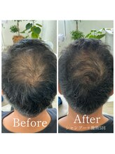 キュライム 熊本(CURAIM)/育毛促進【40代男性】