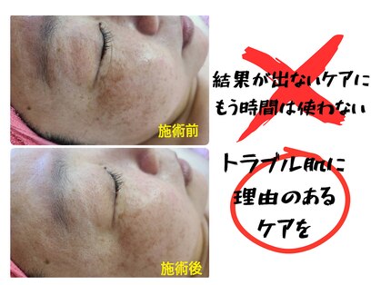 ピュアビューティー(Pure Beauty)の写真