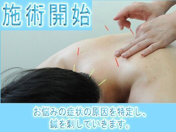 リケア道玄坂鍼灸院 渋谷(reCare)/施術開始