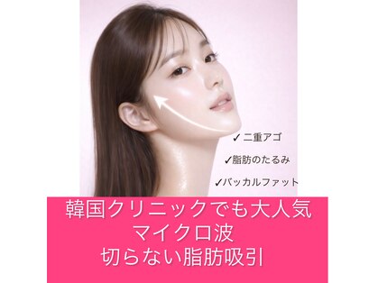 アニスの写真
