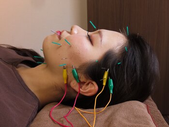 レスピレ 麻布十番(respirer)の写真/【麻布十番3分】身体の内側から整える。本格美容鍼×全身鍼灸で自律神経・睡眠・肌質まで整えます