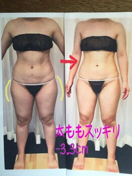 ボディエステティック アクアオーラ 富山店/脚が細い！