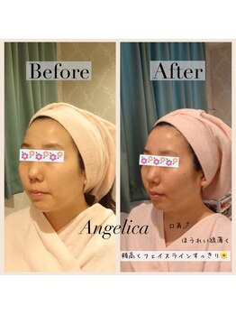 アンジェリカ(Angelica)/あなたをかわいくするエステ