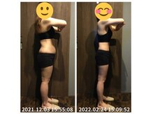 美容整体院元 光の森店/ダイエット3ヵ月　before＆after