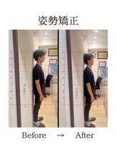 心斎橋長堀フェムテック整骨院/6姿勢矯正　骨格矯正と骨盤矯正
