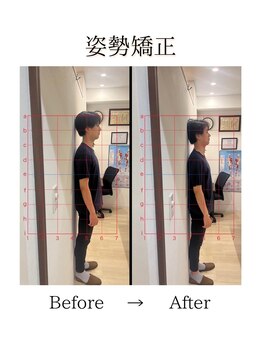 心斎橋長堀フェムテック整骨院/6姿勢矯正　骨格矯正と骨盤矯正
