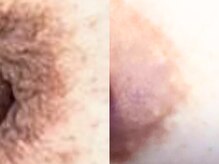 ドアディ(Doordie)/ローマピンク