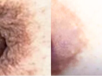 ドアディ(Doordie)/ローマピンク