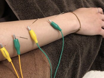 鍼灸 整体院 スズユ(SUZUYU)/【北浜/鍼灸/整体/肩こり改善】