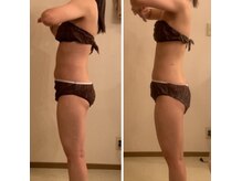 ダイエット痩身★高周波＋筋膜リンパとあらゆる手技で痩身効果◎