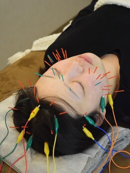 潤(URUOI)の写真/《電気鍼×整体》睡眠の質UP!お仕事での体や眠りの不調に◎上質な睡眠で心身ともにスッキリ軽く☆