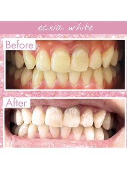 エクシアホワイト 長野店/